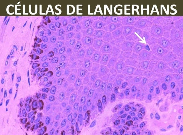 células de langerhans