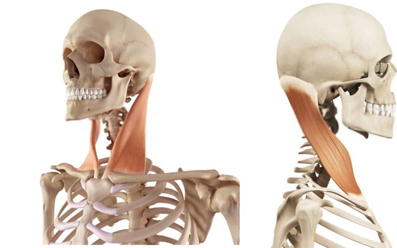 músculo esternocleidomastoideo