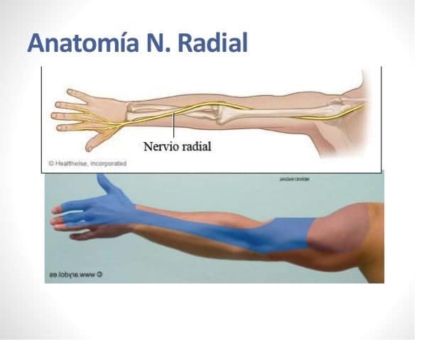 nervio radial