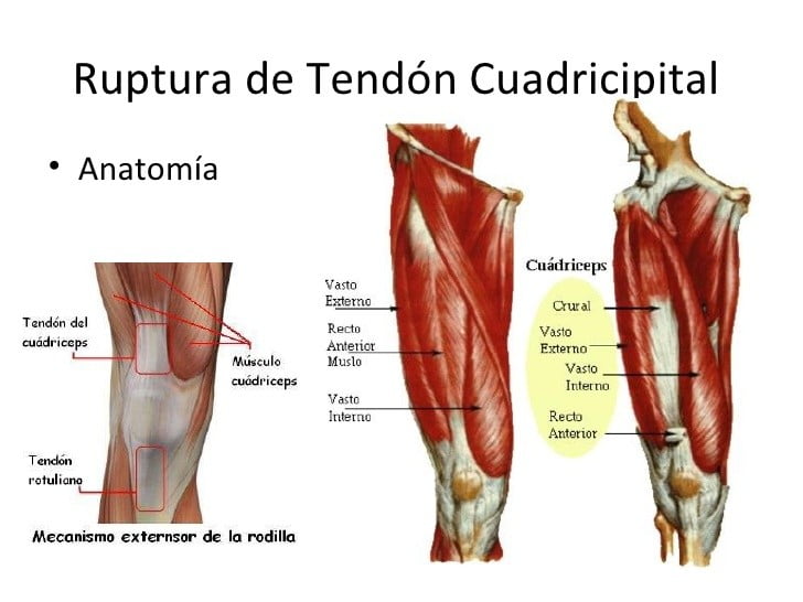 Músculo cuádriceps femoral Musculo cuadriceps femoral