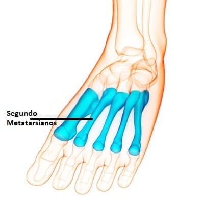 Metatarsianos metatarsianos