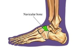 hueso navicular