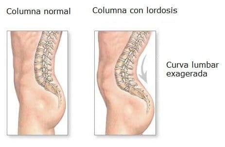 Vértebras lumbares vértebras lumbares