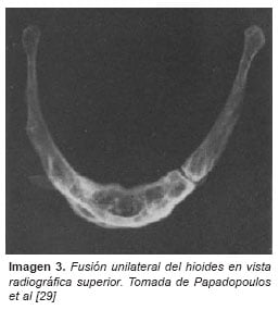 Hueso hioides hueso hioides