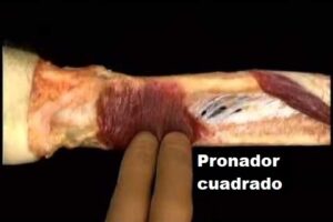 Pronador cuadrado pronador cuadrado
