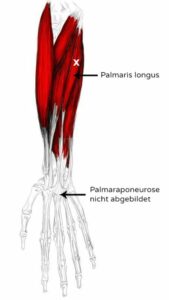 palmar largo