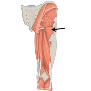 Músculo cuadrado femoral músculo cuadrado femoral
