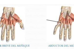 Músculos hipotenares