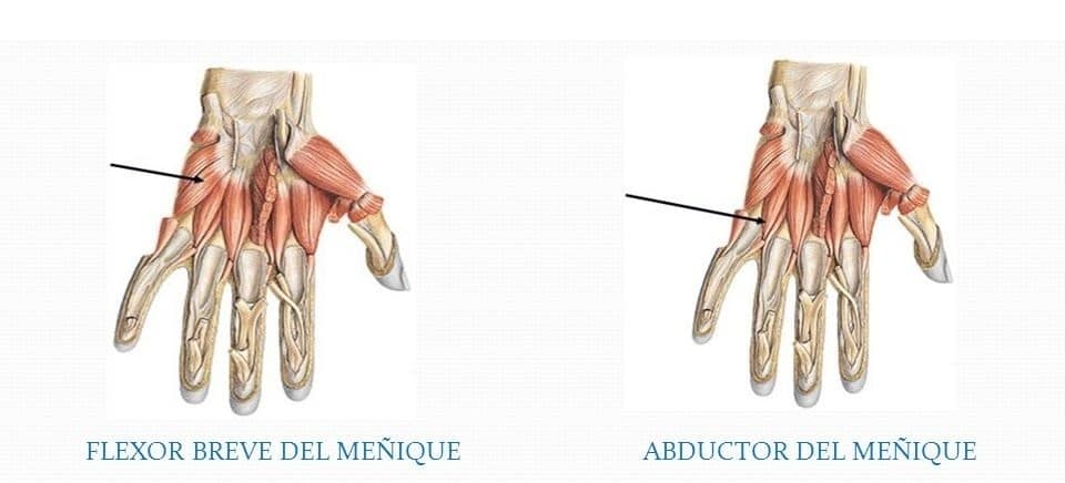 Músculos hipotenares