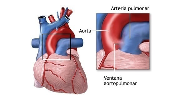 arteria pulmonar