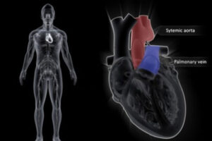 venas pulmonares
