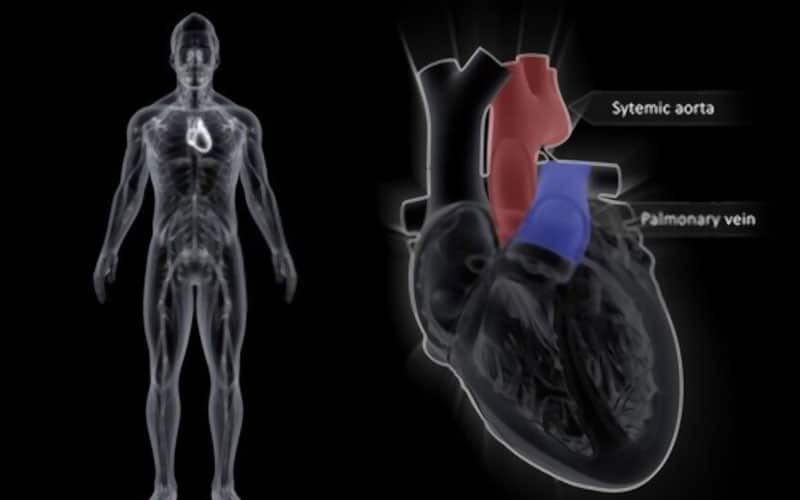 venas pulmonares