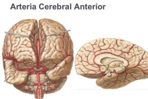 Arteria cerebral anterior