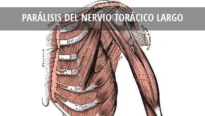 Nervio torácico largo