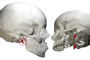 Apófisis estiloides