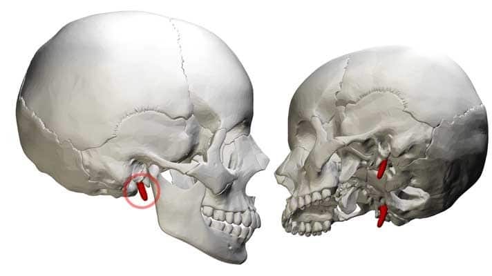 Apófisis estiloides