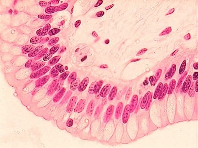 Epitelio estratificado Epitelio columnar estratificado