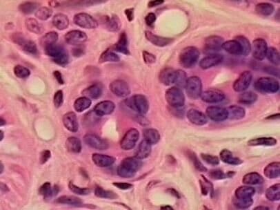 Epitelio estratificado Epitelio cuboide estratificado