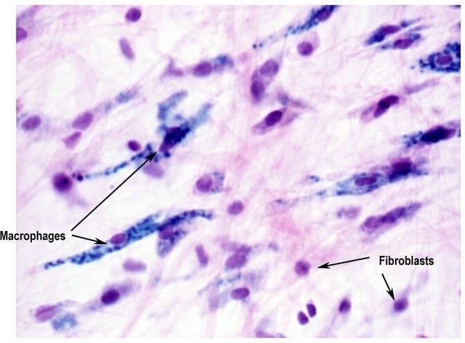 Макрофаги в тканях. Макрофаг гистология препарат. Фибробласты и макрофаги препарат гистология. Макрофаги,фибробласты соединительной ткани. Гистиоциты гистология.
