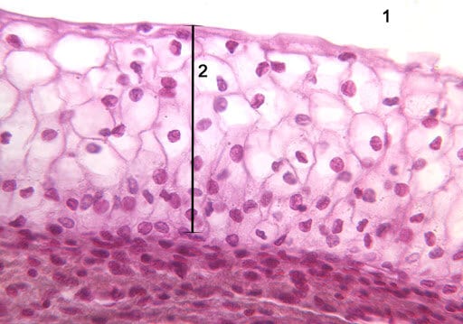 Epitelio estratificado epitelio de transición