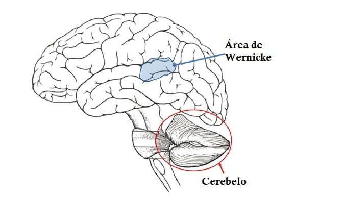 Área de wernicke