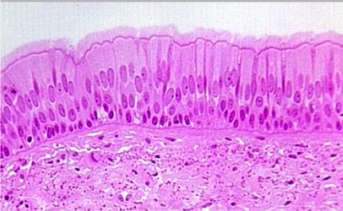 Epitelio cilíndrico pseudoestratificado Epitelio cilíndrico pseudoestratificado