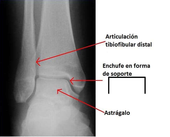 articulación del tobillo