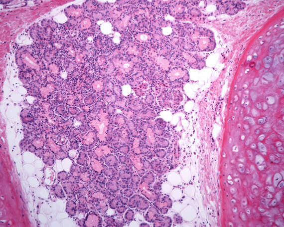 Histología del tracto respiratorio superior Histología del tracto respiratorio superior