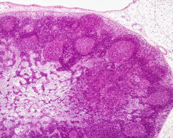 Histología de los ganglios linfáticos Histología de los ganglios linfático