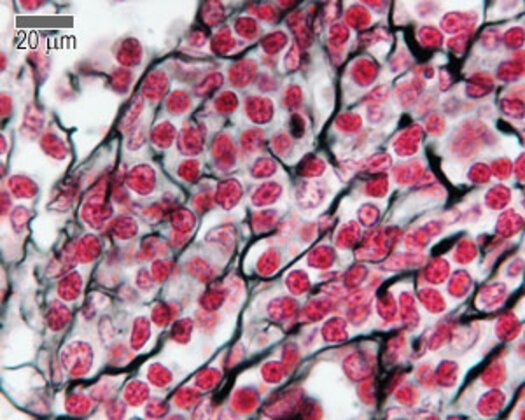 Histología de los ganglios linfáticos ganglios linfáticos