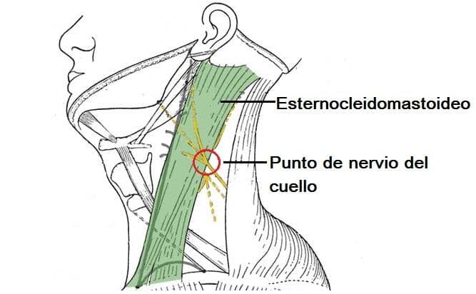 Plexo cervical plexo cervical