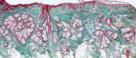 Histología del cuero cabelludo y del cabello Histología del cuero cabelludo