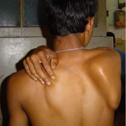 Músculos de la región pectoral Músculos de la región pectoral